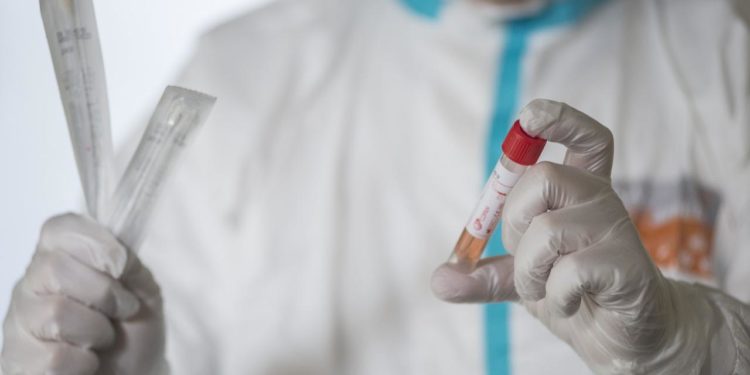 Coronavirus, l’interpellanza di Cannata (FdI) sui tamponi: “priorità a Forze dell’Ordine e categorie a rischio”