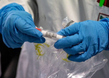 Fuori dalla propria abitazione nonostante la positività al Covid-19: multato e denunciato