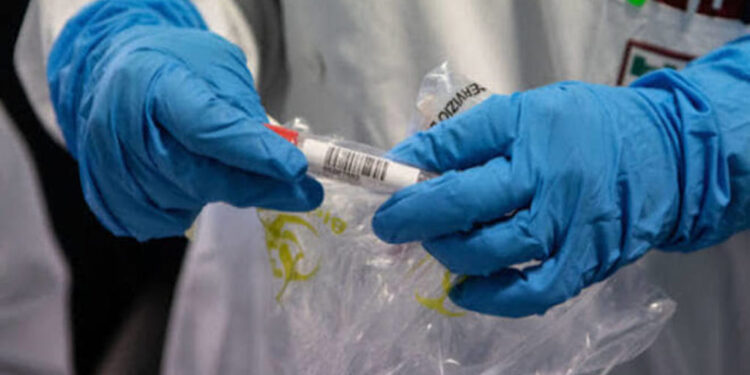 Fuori dalla propria abitazione nonostante la positività al Covid-19: multato e denunciato